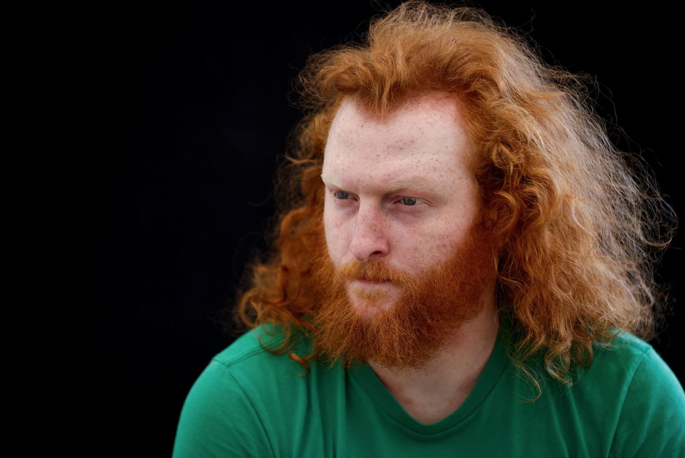 來自愛爾蘭的紅髮男Carl。(路透社)