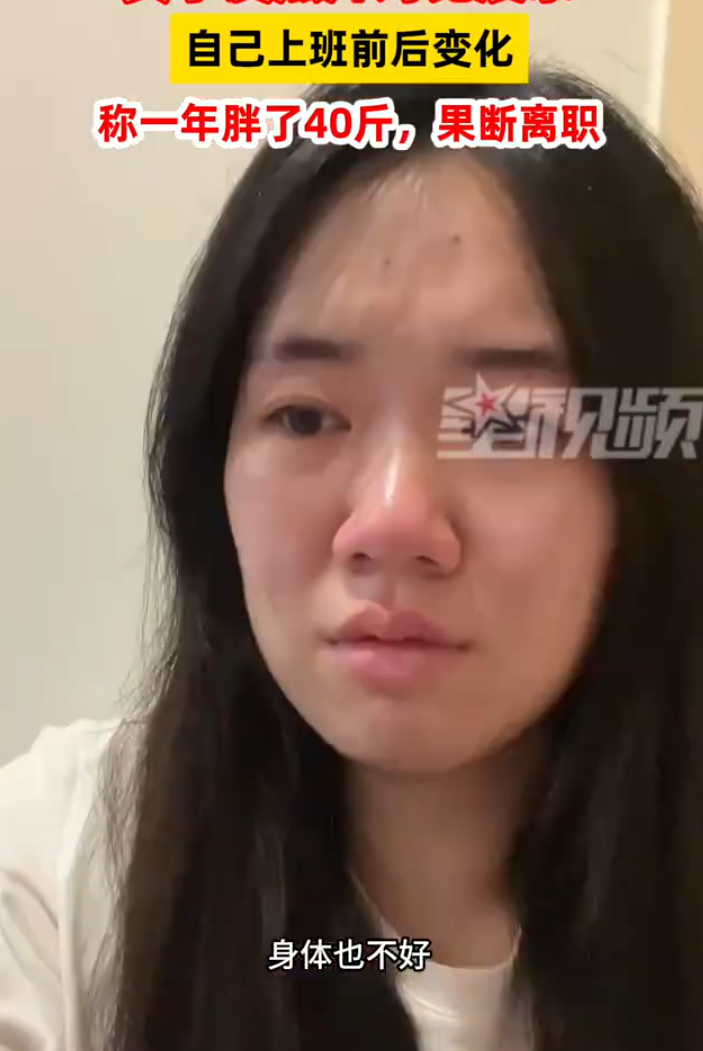 東莞年輕女子小歐畢業後上班一年多,竟暴肥20公斤,健康狀況急劇惡化,於是她果斷辭職,她前後對比照片差異讓不少網民感到驚訝,簡直判若兩人。