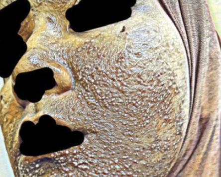 女事主忽然爛面,令她懷疑自己撞鬼。(互聯網)