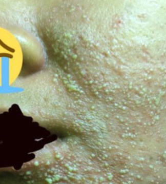 女事主忽然爛面,令她懷疑自己撞鬼。(互聯網)