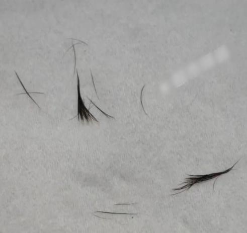 全部拉出來後才發現是一大撮眼睫毛。(微博)