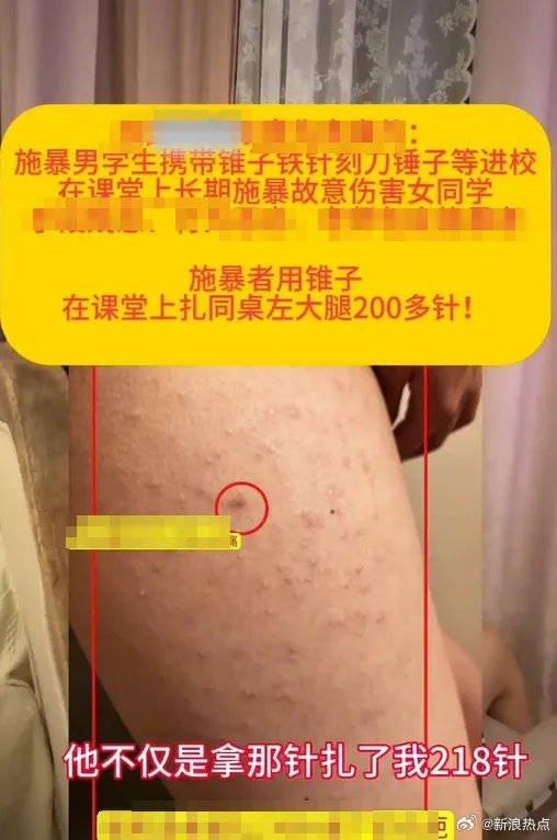 女童指被同桌男同學用鐵錐刺身體逾200下,連衣服都被刺出多個孔。(微博)