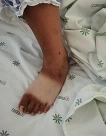 家屬稱,直至女兒被送進醫院,學校才通知家屬,女兒已經遍體鱗傷。(微博)