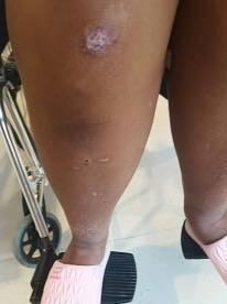 家屬稱,直至女兒被送進醫院,學校才通知家屬,女兒已經遍體鱗傷。(微博)