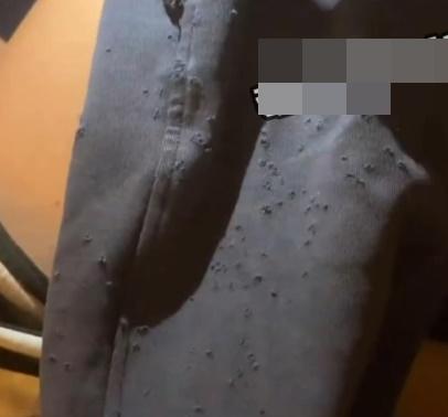 女童指被同桌男同學用鐵錐刺身體逾200下,連衣服都被刺出多個孔。(微博)