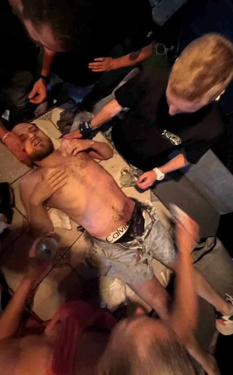 網上相片可見,Smirnov穿著的運動鞋幾乎被燒成碎片,短褲和內褲也被燒焦,胸口及腳的皮膚被燒傷脫皮。(X)