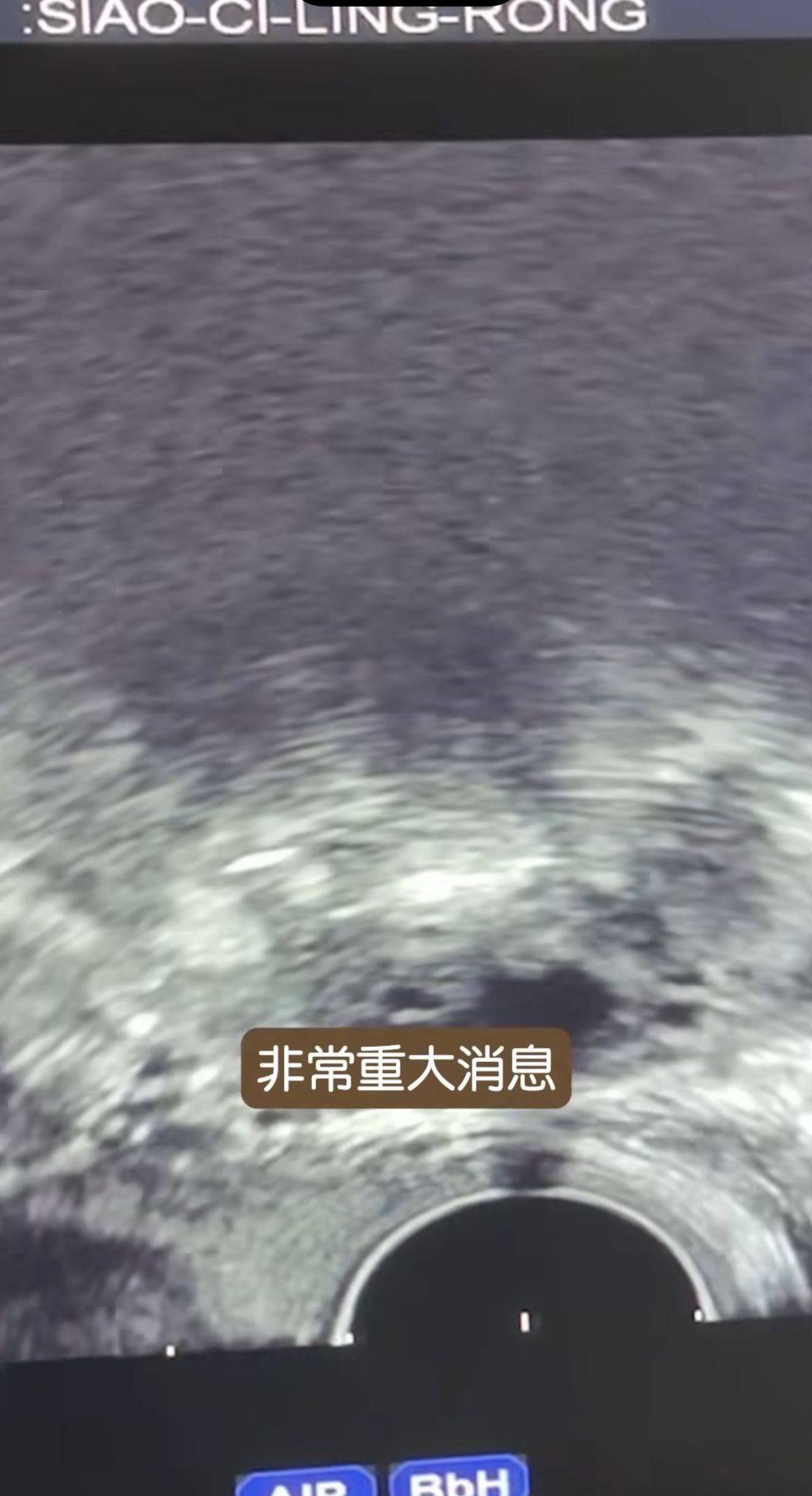 篠崎泫把YouTube上的雪卵影片剪成短片Reels分享至IG。