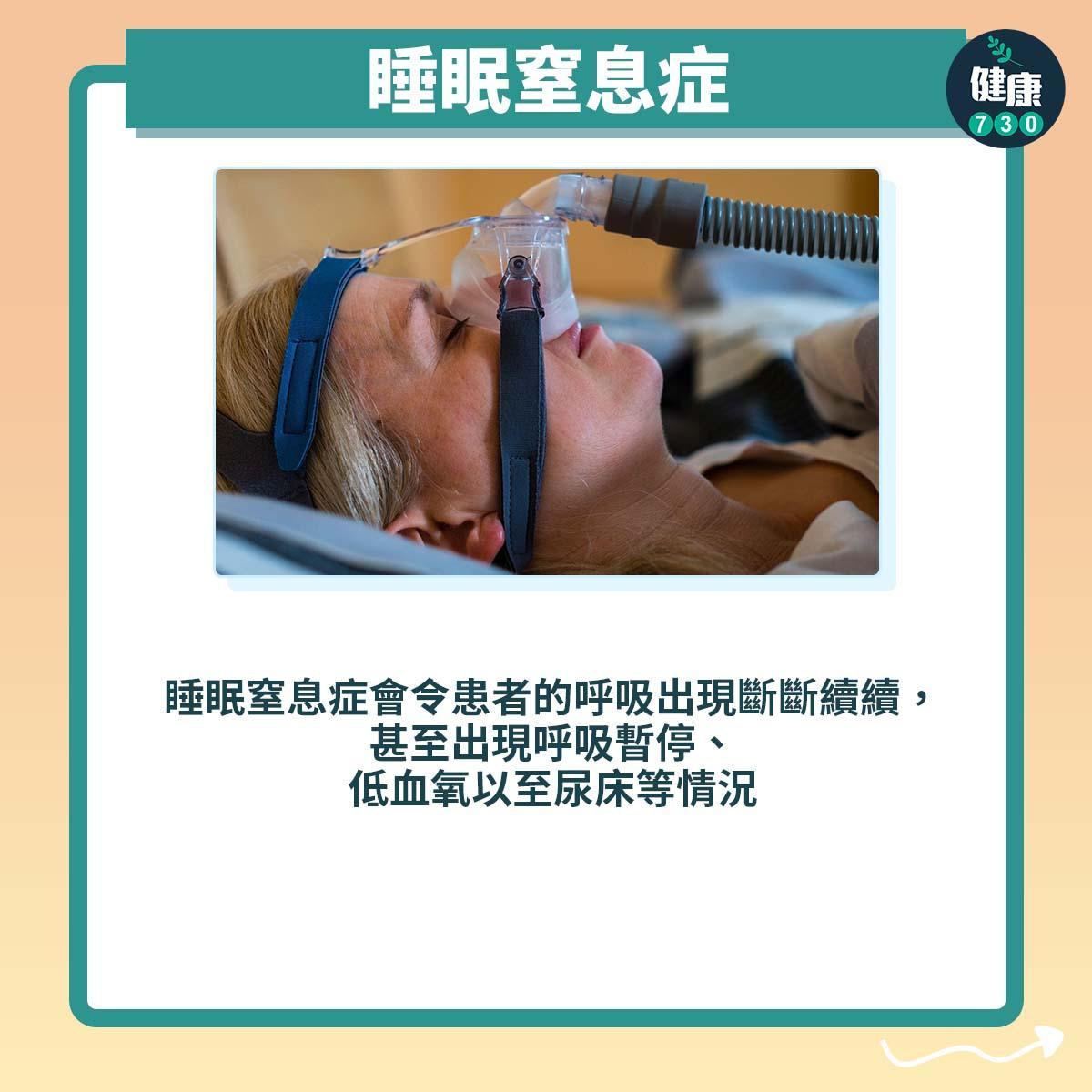成年人尿床原因丨睡眠窒息症(am730製圖)