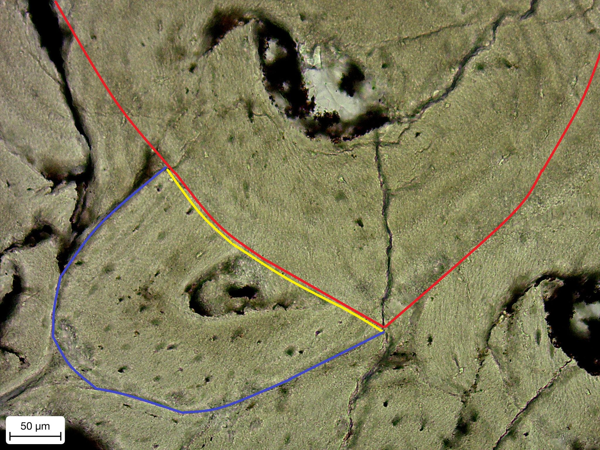 放大的骨組織,紅色線範圍為新一代次級骨單位(the new generation of secondary osteon),藍色線範圍為老一代次級骨單位(the old generation of secondary osteon)。隨著恐龍成長變老,在骨頭改建過程中,新一代的次級骨單位會吸收老一代的次級骨單位 (見黃色吸收線(resorption line),黃色箭頭為方向),佔據老一代次級骨單位曾經佔據的空間。(古脊椎)