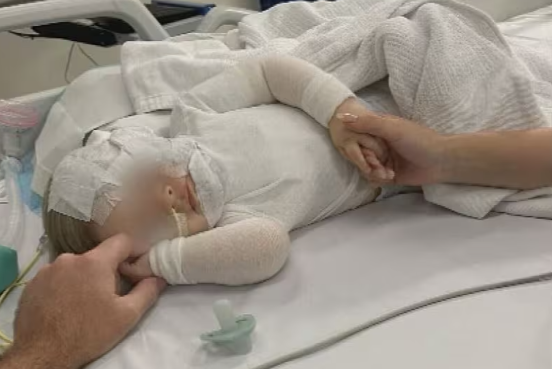 9個月大的盧卡(Luka)和母親在布里斯本一公園野餐玩耍時,突被一名不認識的男子潑灑熱咖啡,然後奔跑離開。盧卡的面部、上身和手臂嚴重燒傷