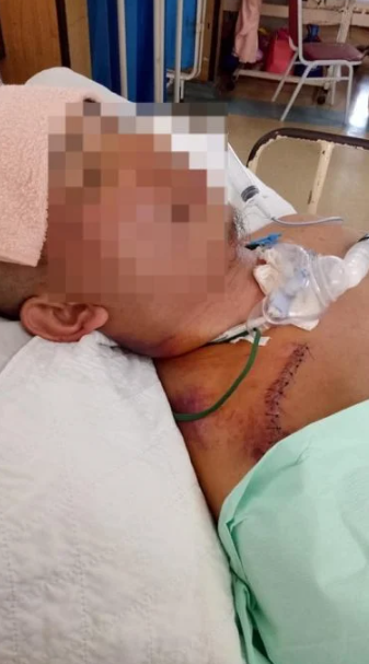 女事主前夫卧床6年。(互聯網)