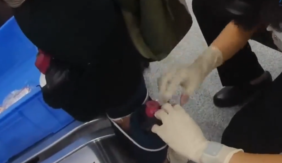 港女用彈力繃帶綁藏6瓶茅台酒。(「海關發布」微信公眾號)