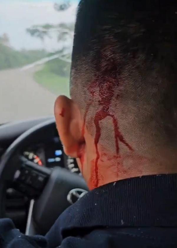司機後腦流血。(X)