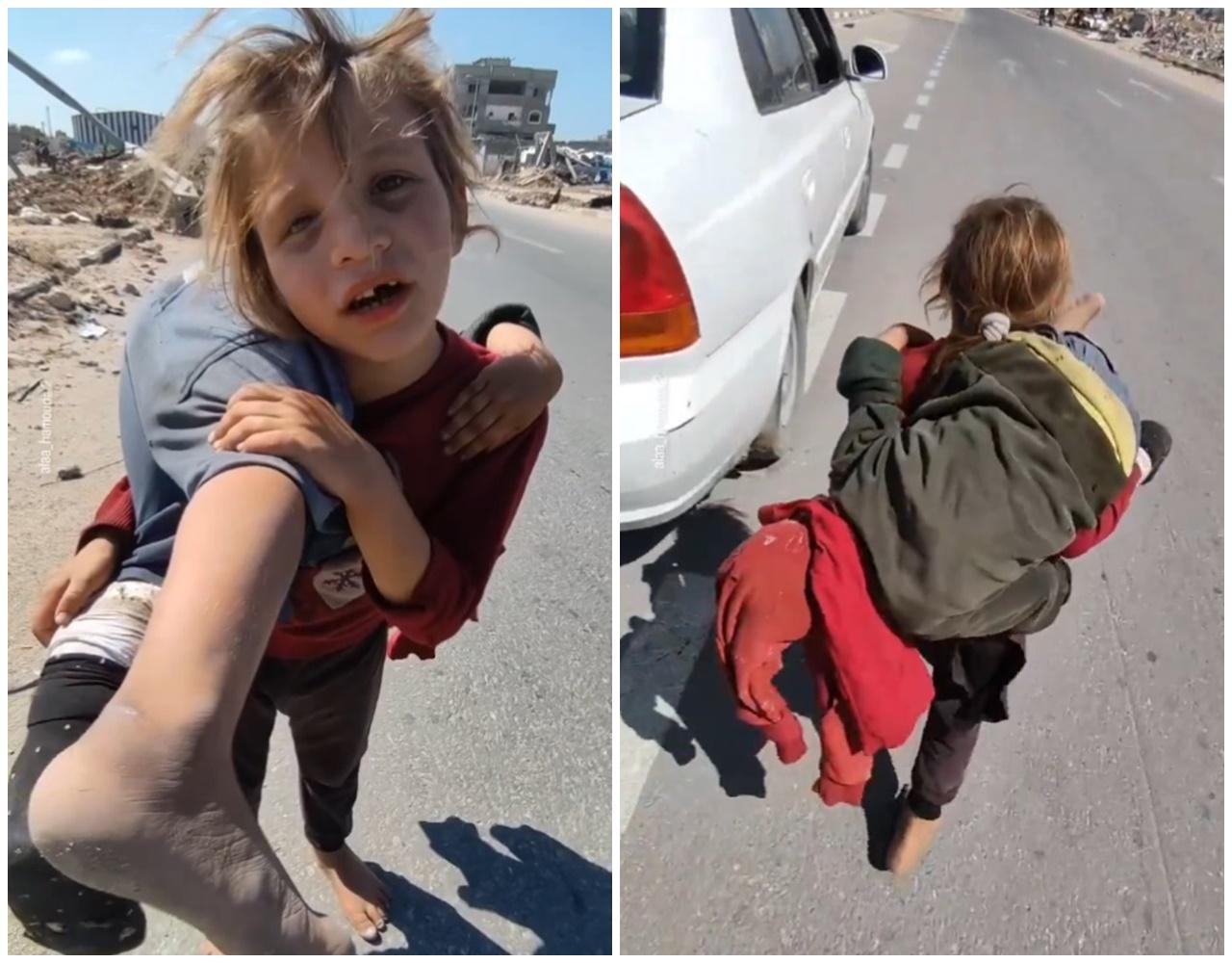 Alaa詢問女童為何背著妹妹時,她回答:「她被車撞了」。(X)