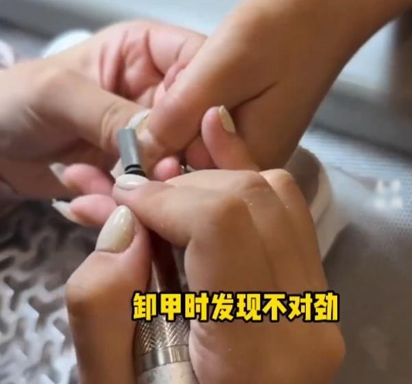 店家表示:「剛看到指甲的時候就覺得不對勁了……當看到本甲的時候人都麻了」。(微博)