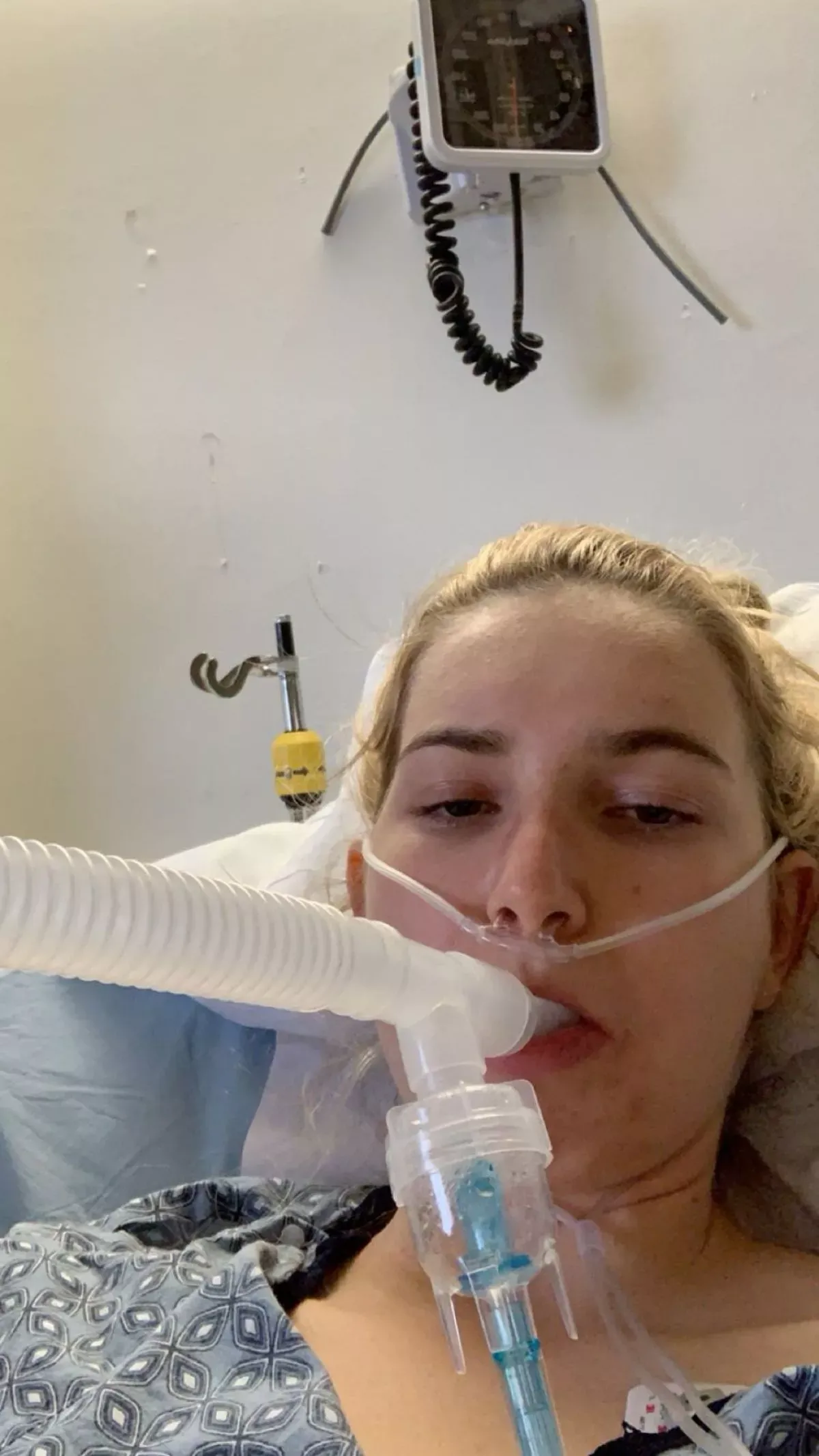 昆妮 (Caroline Cray Quinn) 曾因接吻而出現症狀。