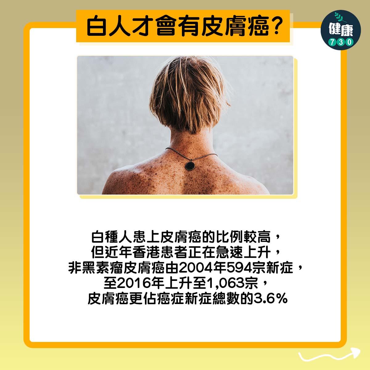 皮膚癌3大謬誤|白人才會有皮膚癌?(am730製圖)