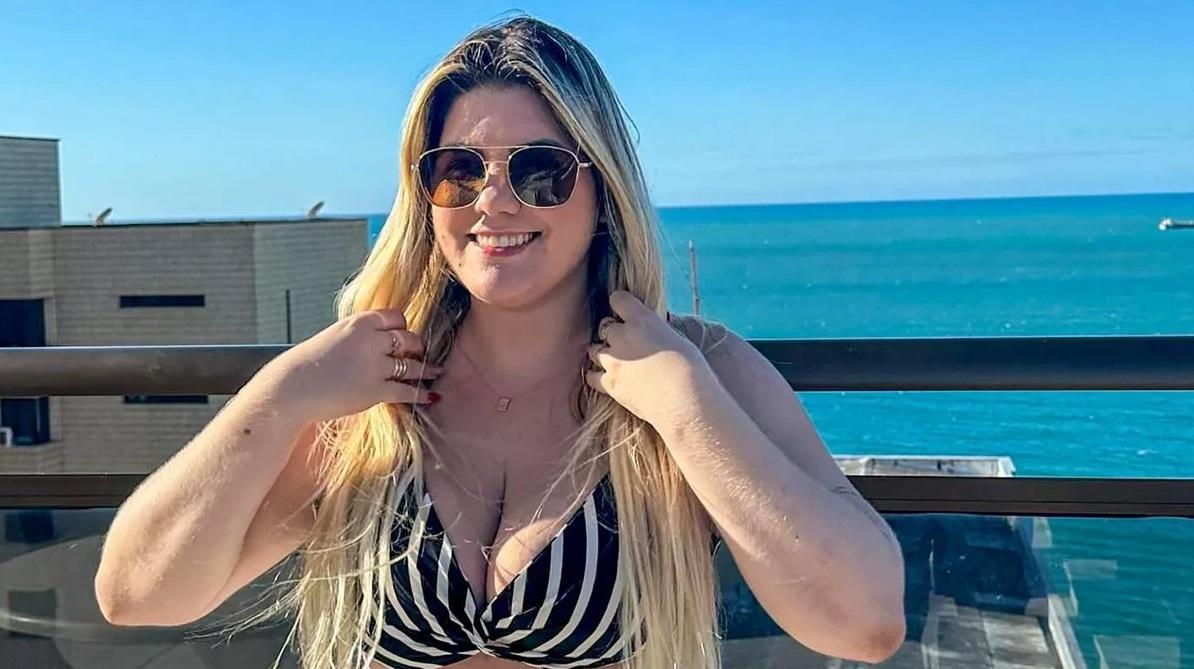 巴西女子蒙特8小時內接受6次整容手術,最終因嚴重併發症死亡。(互聯網)