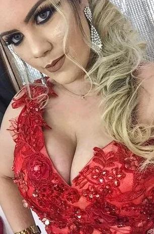 巴西女子蒙特8小時內接受6次整容手術,最終因嚴重併發症死亡。(互聯網)