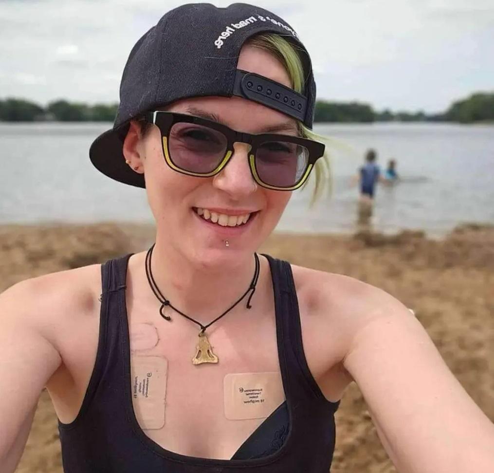 奈廷格爾患上罕見「急性間歇性紫質症」,導致新陳代謝紊亂。(互聯網)