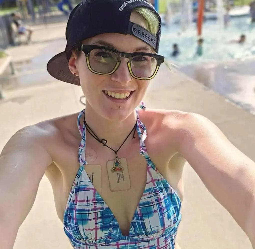 奈廷格爾須避開猛烈陽光,因此皮膚蒼白。(互聯網)