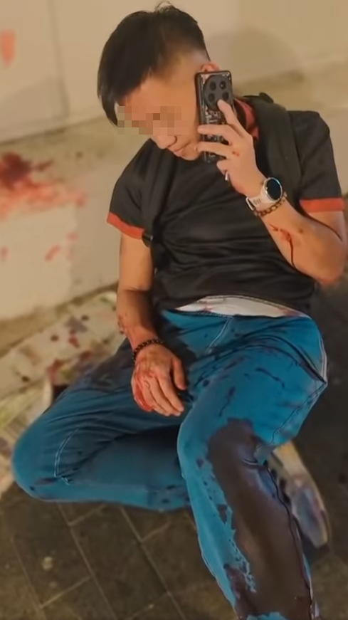 休班PTU警長彌敦道街頭遭搶銀包,與一名南亞裔持刀男子糾纏時被襲擊致手腳浴血,事後臥地打電話求助(影片截圖)