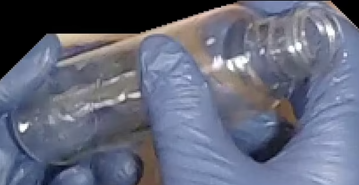 婦科醫生Arne Bye涉嫌以瓶子及除臭劑器皿侵犯女病人。(互聯網)