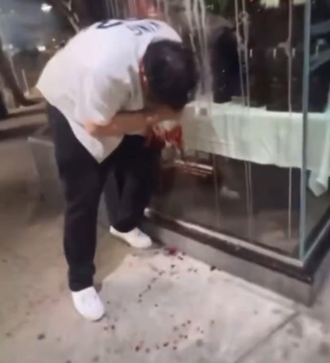 男子疼痛的倚靠在路旁的玻璃窗前,鮮血不停滴落地上。(X)