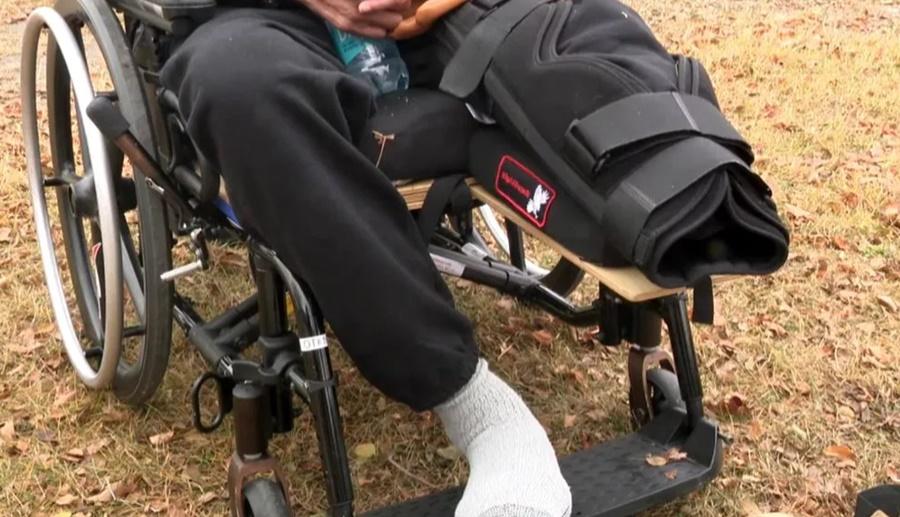 事主對僅餘一隻有待截肢的腿而感擔憂。(X)