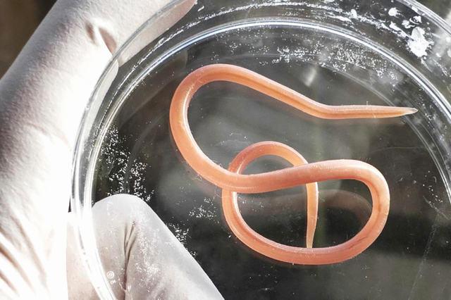 醫生指,將含有蟲卵的泥土吃下肚,當孵化成蛔蟲,蛔蟲聚集過多時,就會造成腸道阻塞,進而出現營養不良和腹痛的症狀。(網上圖片)