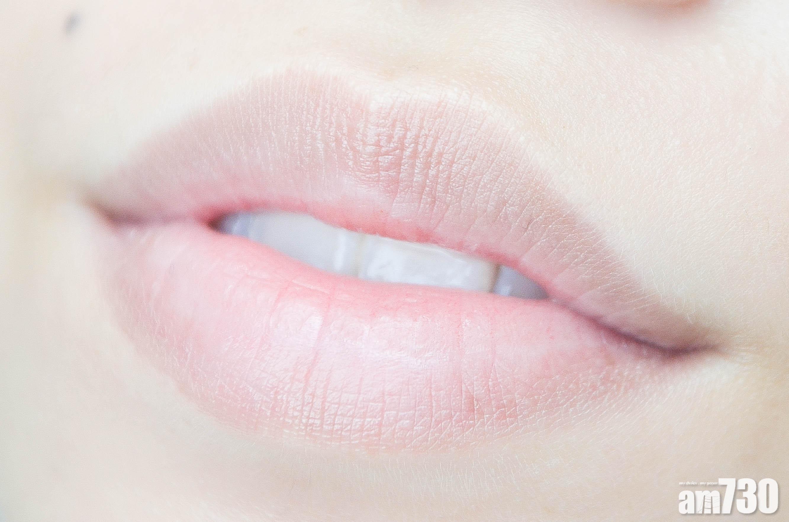 嘴唇發白主要因為血氣不足。