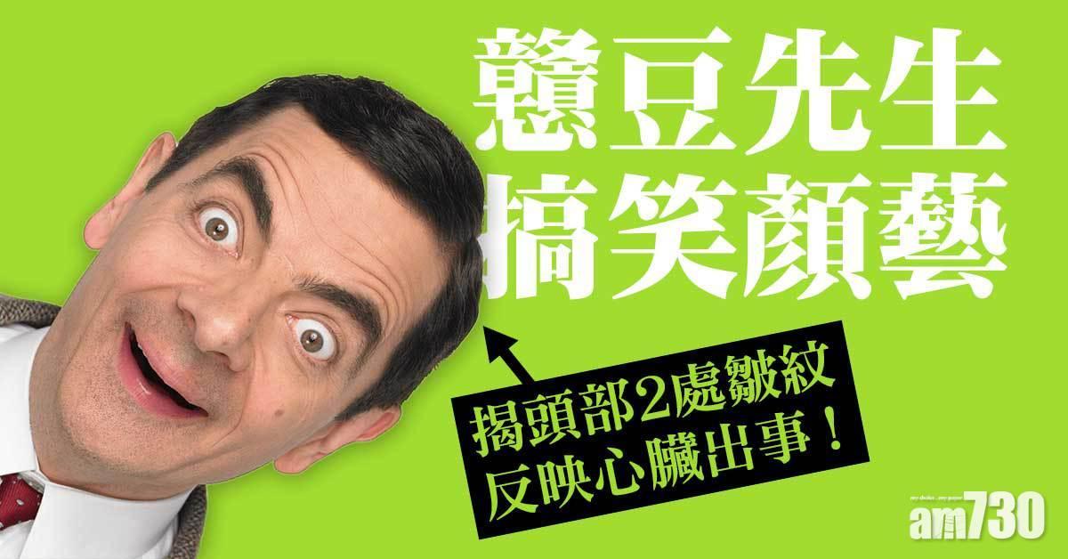 皺紋位置丨頭部兩處出現 或跟心臟病有關(am730製圖)