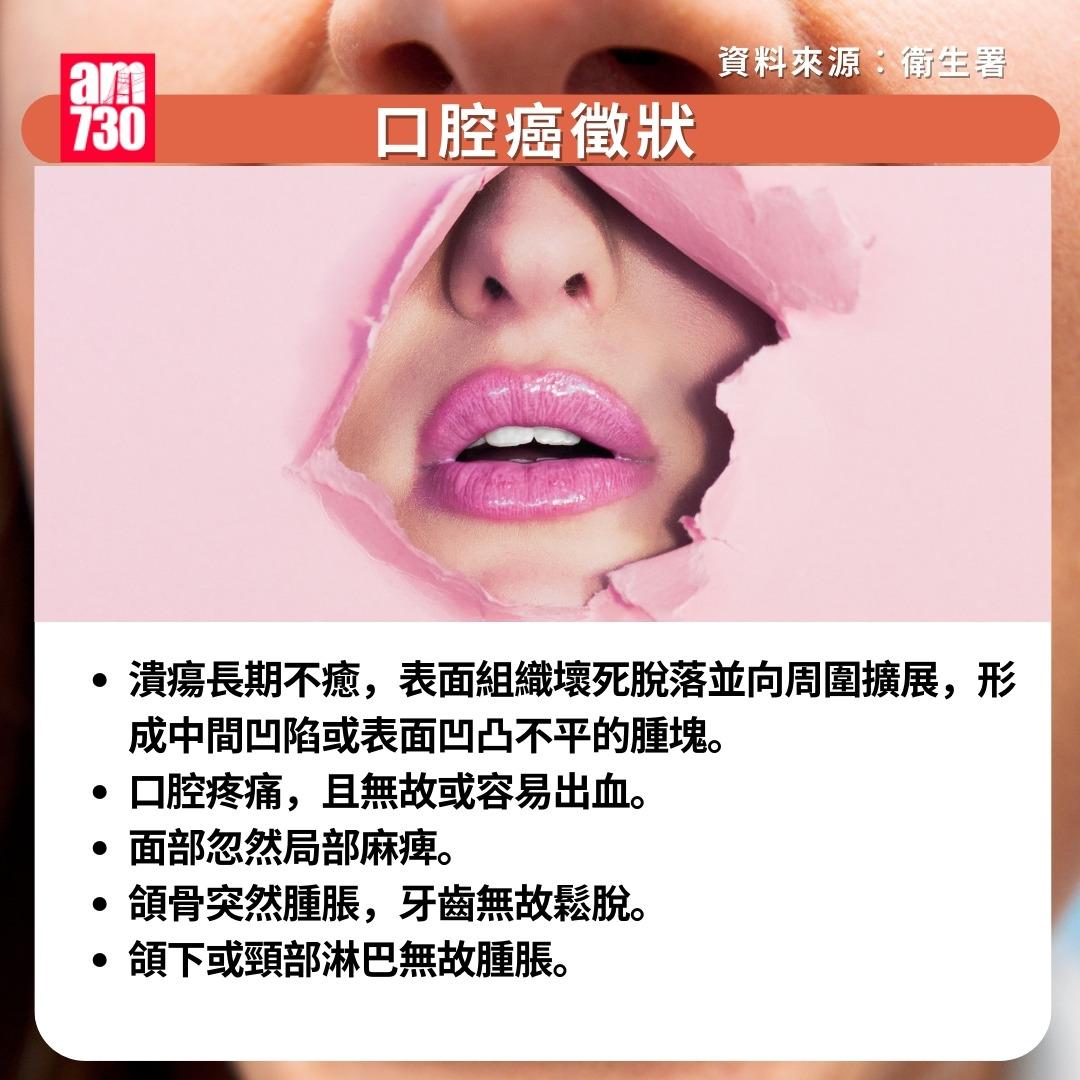 口腔癌原因/症狀/治療/預防方法|徵狀(am730製圖)