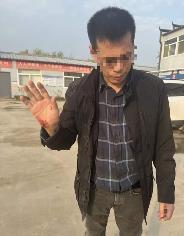 新華社《經濟參考報》調查記者王文志、程子龍採訪過程中遭遇襲擊。(網上圖片)