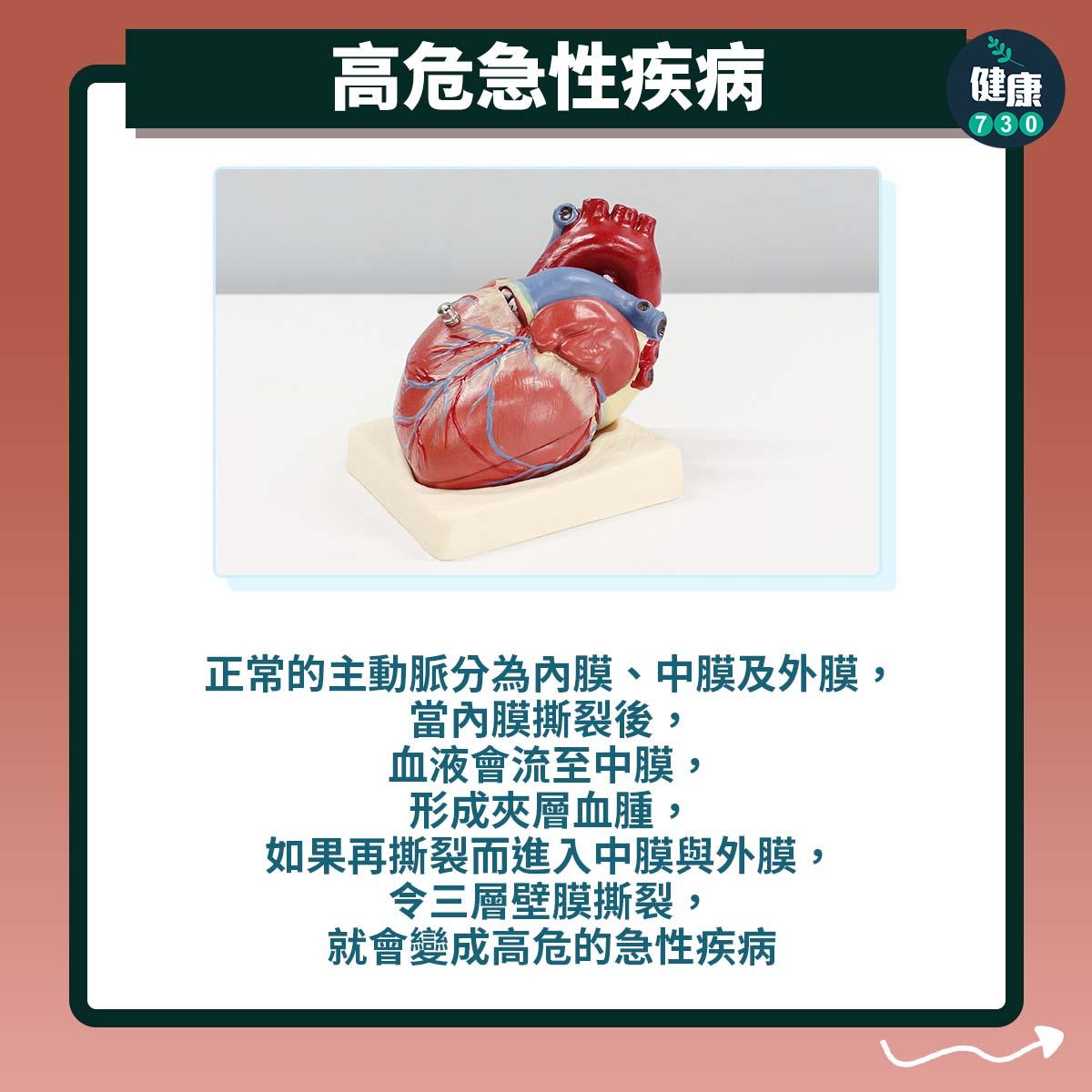 血管撕裂易被誤為冠心病發|高危急性疾病(am730製圖)