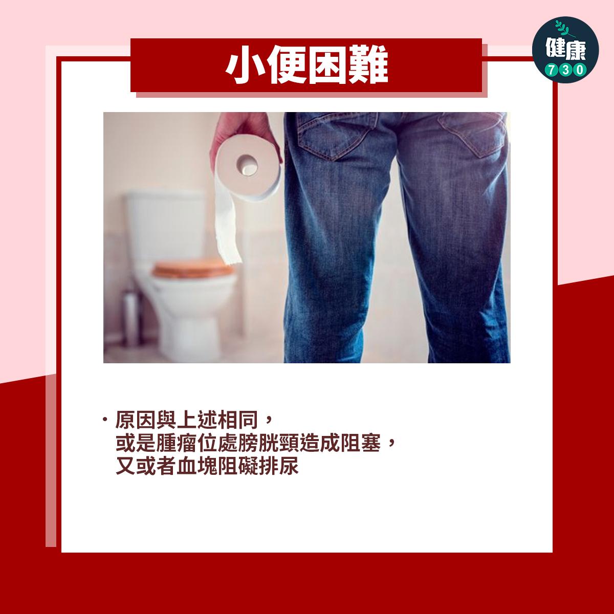 膀胱癌症狀|小便困難(am730製圖)