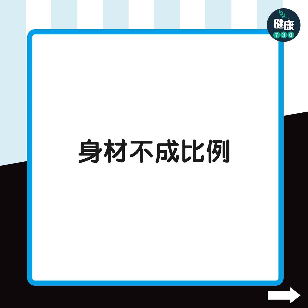 侏儒症症狀|身材不成比例(am730製圖)