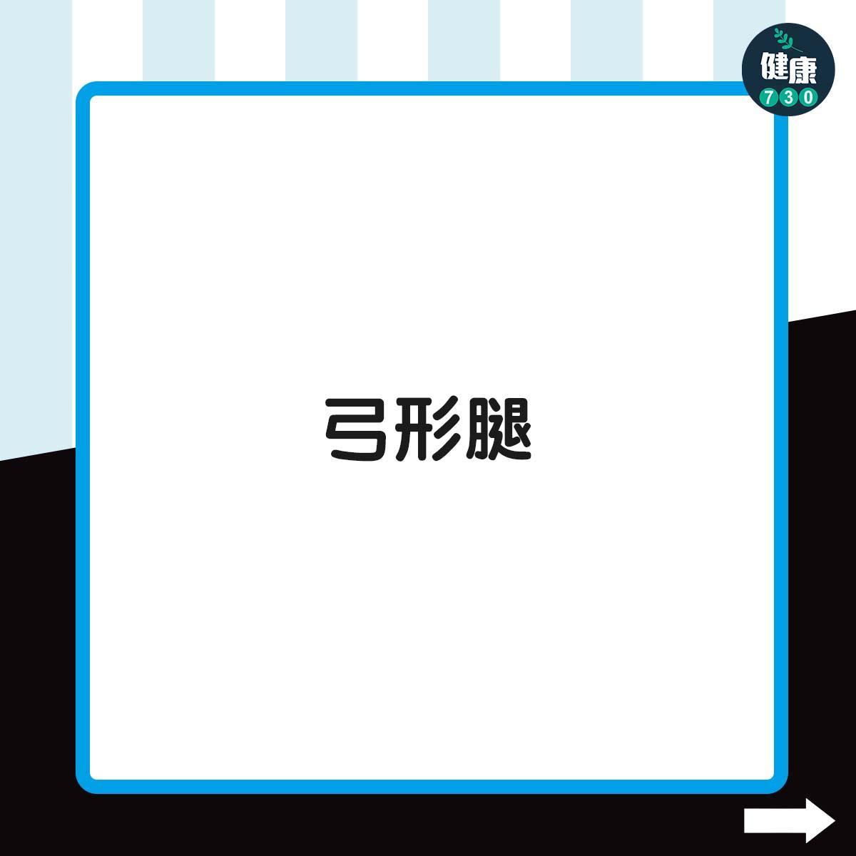 侏儒症症狀|弓形腿(am730製圖)