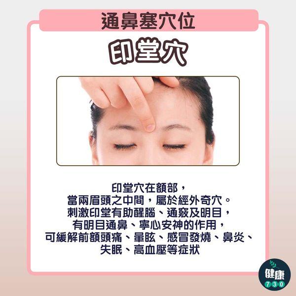 鼻塞好難頂,按3穴位緩解不適|印堂穴(am730製圖)