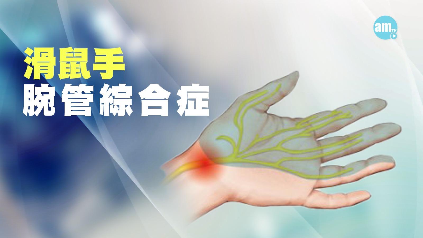 滑鼠手,也叫腕管綜合症,通常是由於長時間使用滑鼠或鍵盤,手腕處的正中神經受到壓迫,導致手掌部分麻木、灼痛或無力,甚至在晚上症狀會加劇。