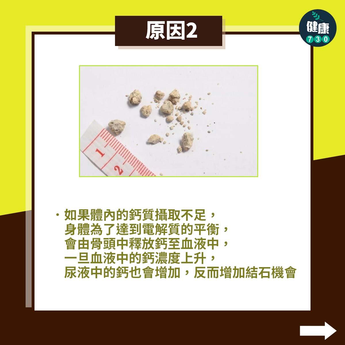 鈣不足反而更易生腎石|原因(am730製圖)