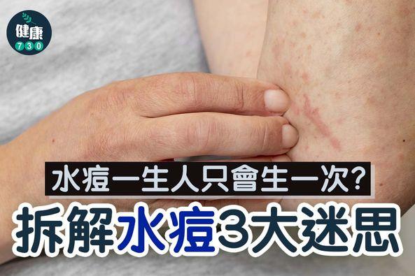 水痘一生一次?拆解3大迷思丨(am730製圖)