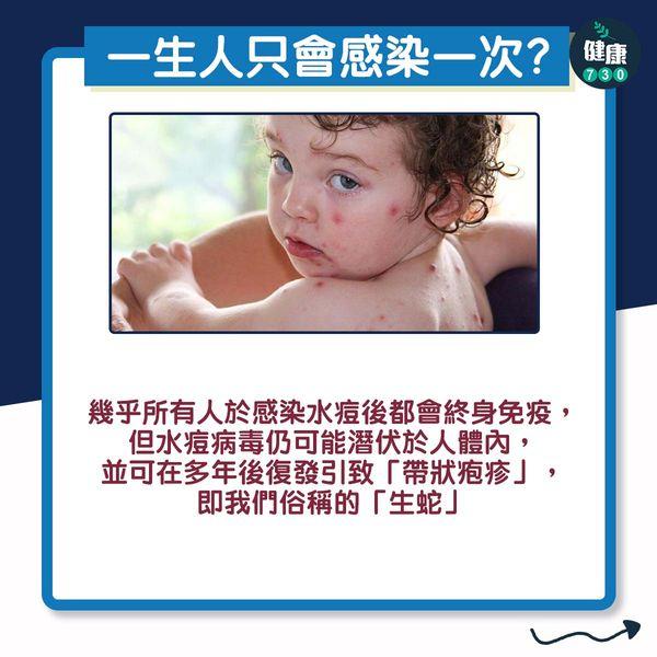 水痘一生一次?拆解3大迷思丨(am730製圖)