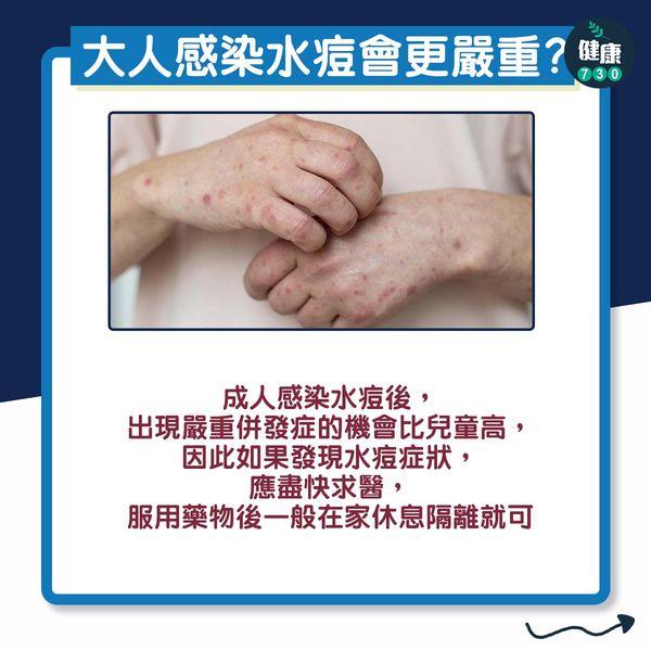 水痘一生一次?拆解3大迷思丨大人感染會更嚴重?(am730製圖)