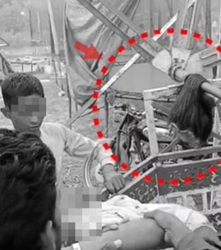 少女的頭髮連頭皮留在座位上,十分駭人。(互聯網)