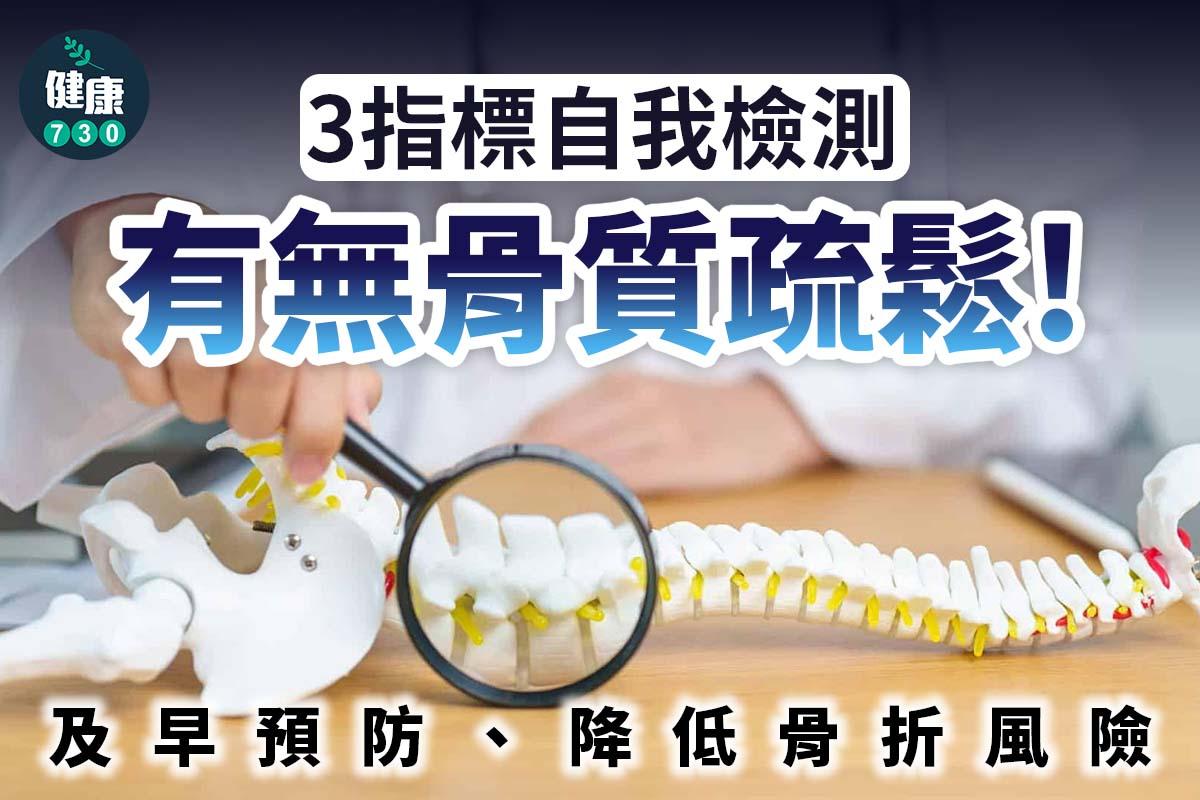 骨質疏鬆檢查|3指標自我檢測(am730製圖)
