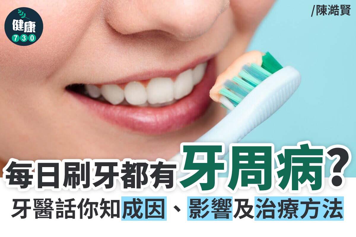 牙周病原因、影響及治療方法|每日刷牙都有牙周病?(am730製圖)