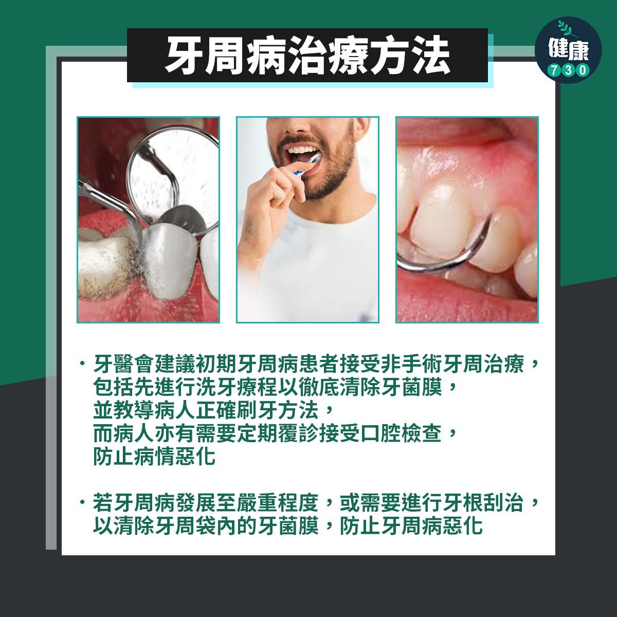 牙周病原因、影響及治療方法|洗牙療程(am730製圖)