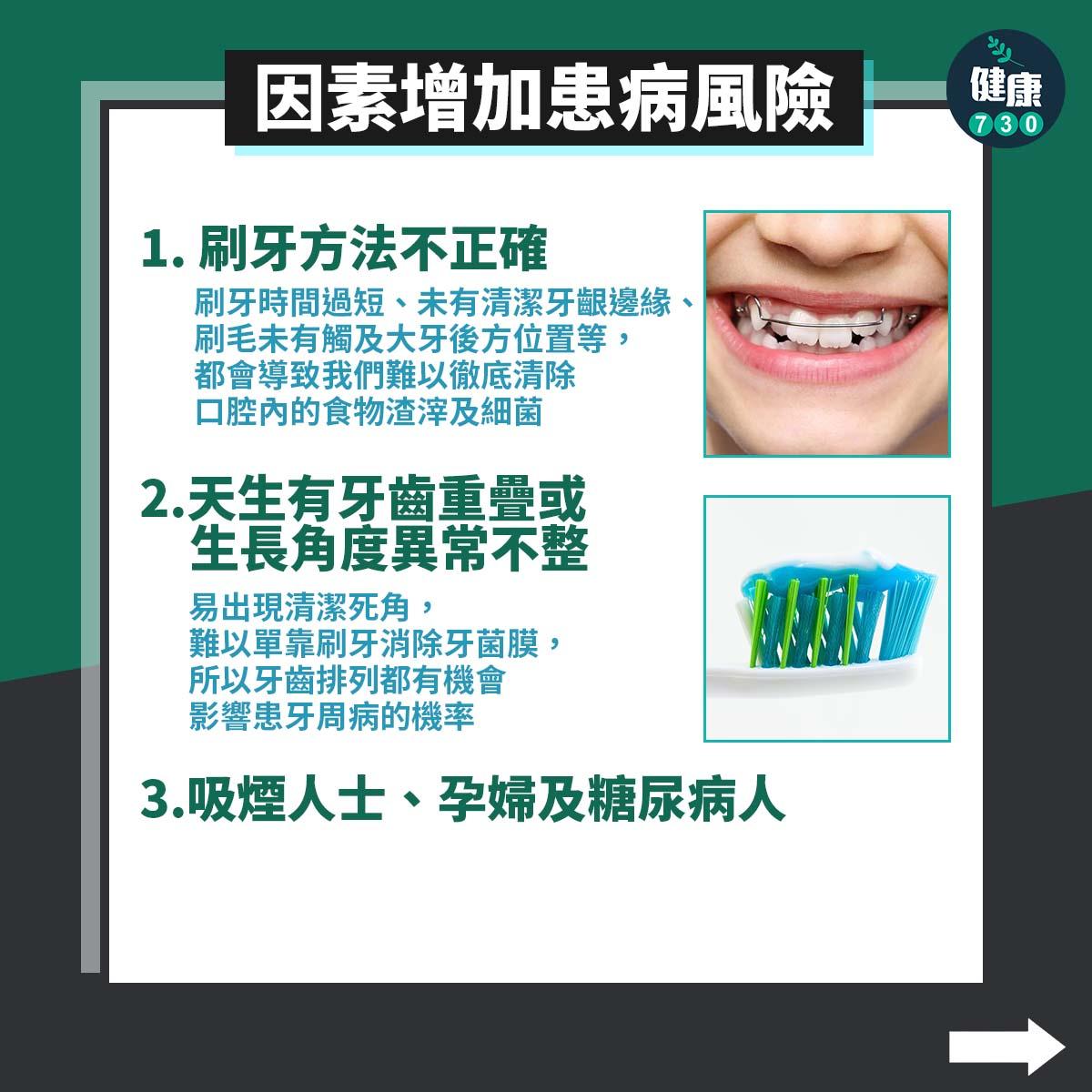 牙周病原因、影響及治療方法|刷牙方法不正確?(am730製圖)