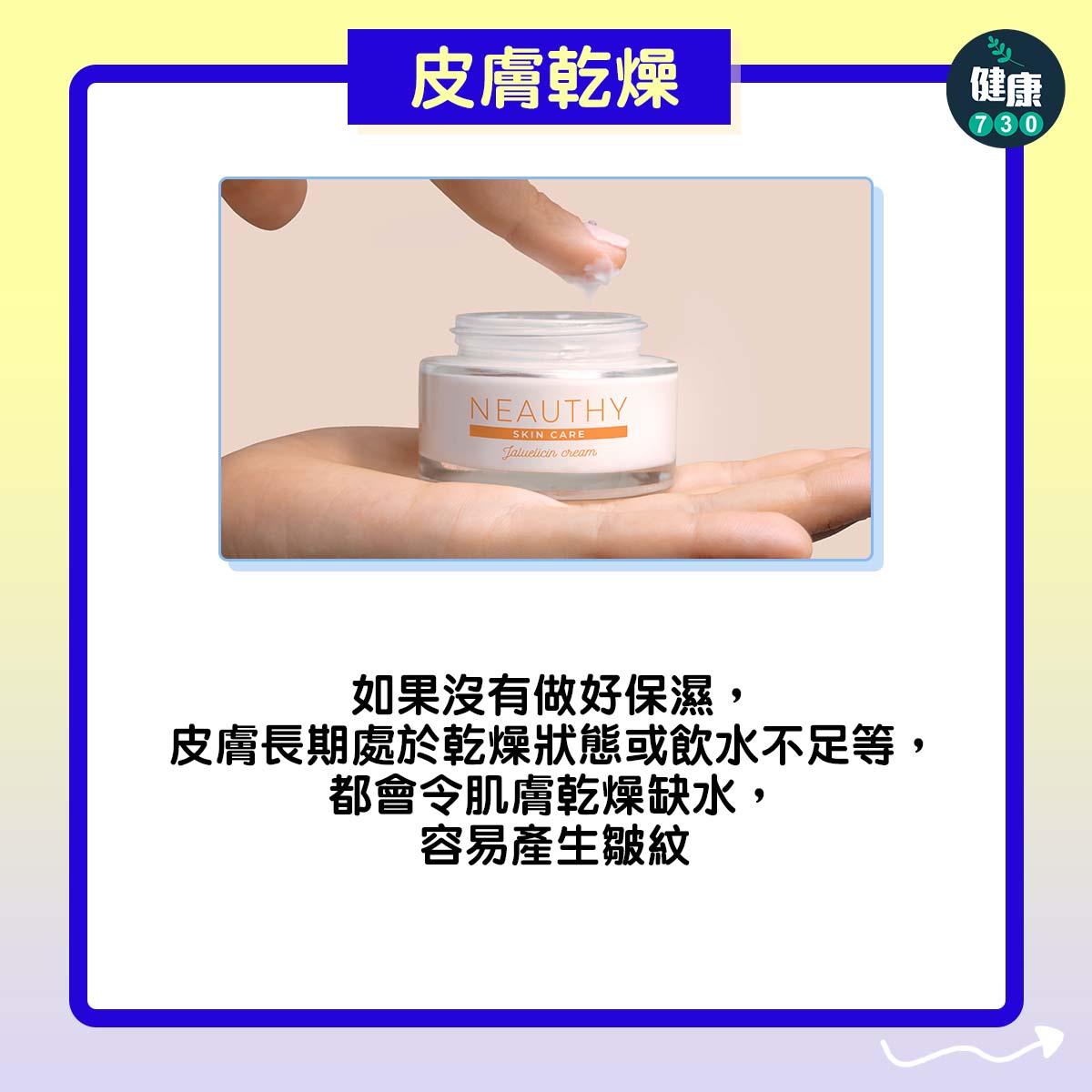 4個生皺紋常見成因|皮膚乾燥(am730製圖)